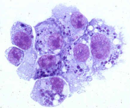 Patogeny lidské anaplasmózy (rodina Anaplasmataceae)